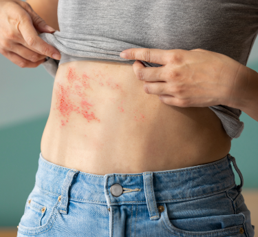 كل ما تحتاج لمعرفته عن  الحزام الناري – أعراضه وأسبابه وعلاجه