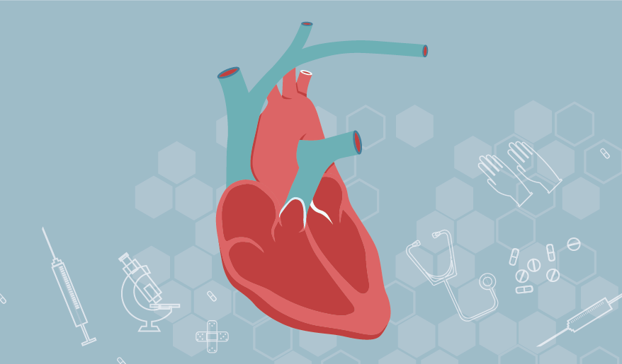 What Happens During a Heart Transplant (Infographic)