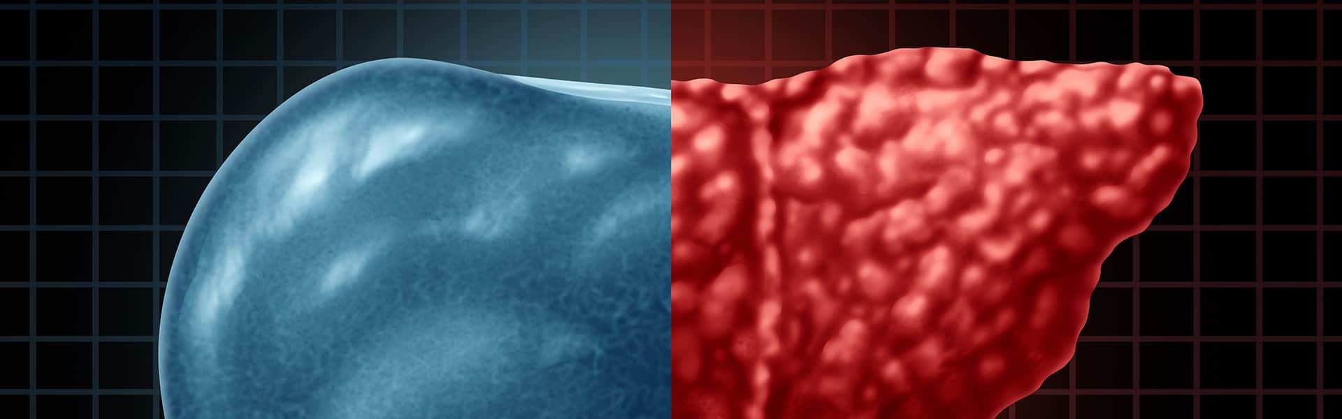 Liver Cancer Program