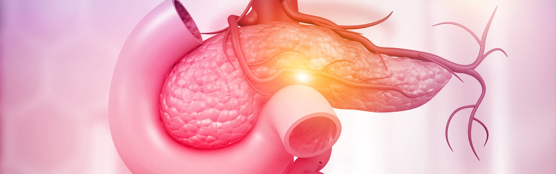 برنامج علاج سرطان البنكرياس  القناة الصفراوية