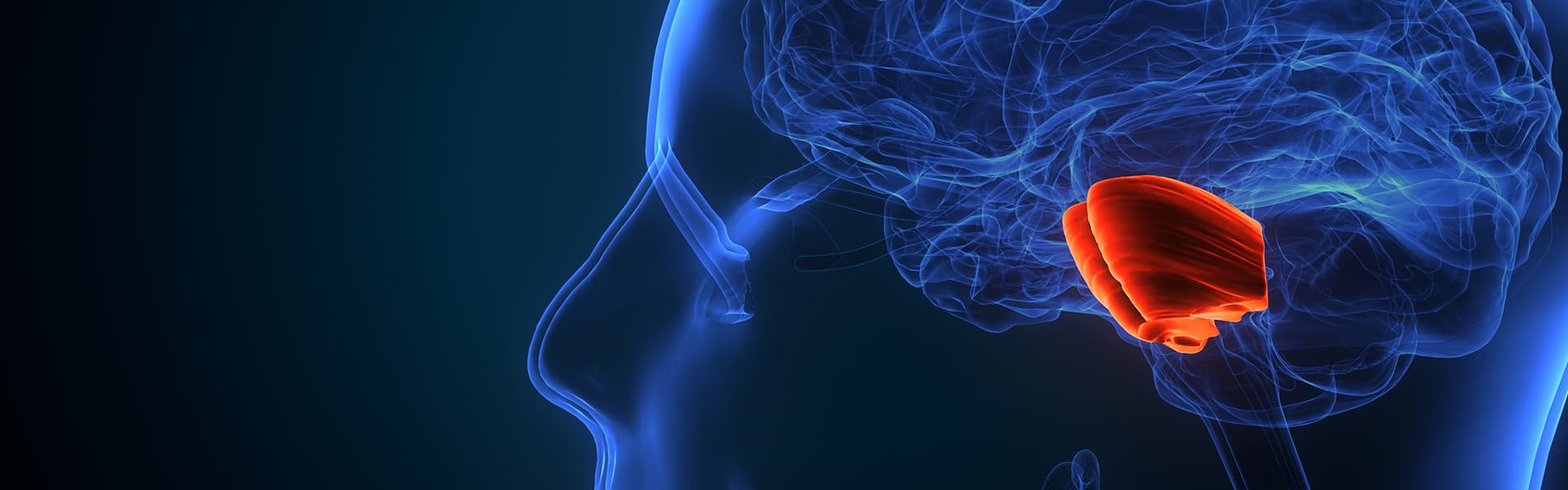 برنامج علاج أورام الغدة النخامية