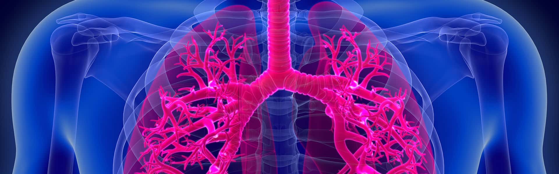 برنامج علاج أورام القصبة الهوائية