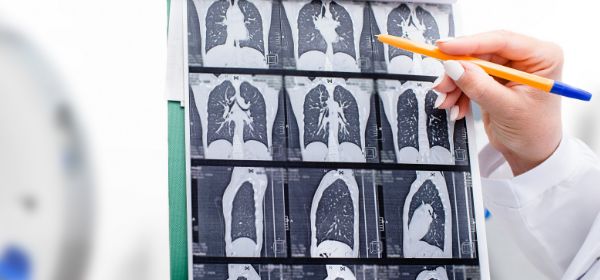 Thoracic Cancers Program