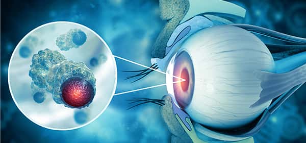 Colorectal Cancer Program