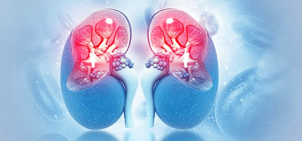 Kidney Cancer Program