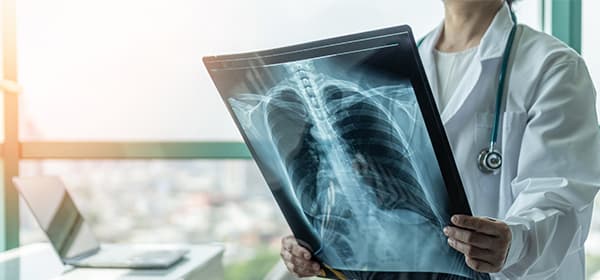 Cervical Cancer Program