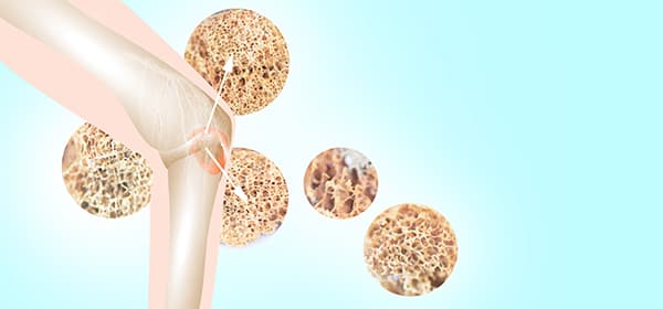 Colorectal Cancer Program