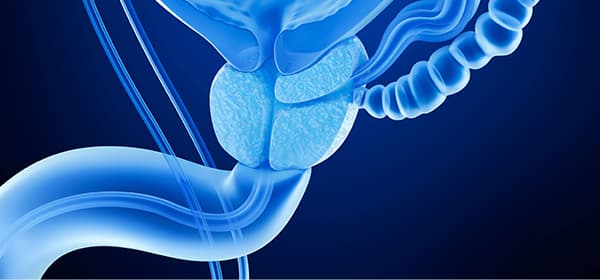 Prostate Cancer Program