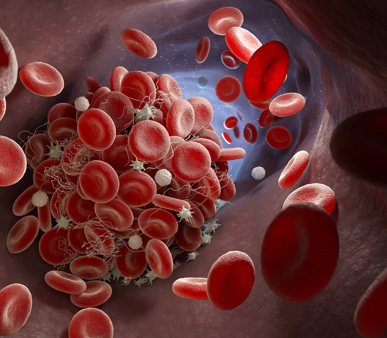 Colorectal Cancer Program