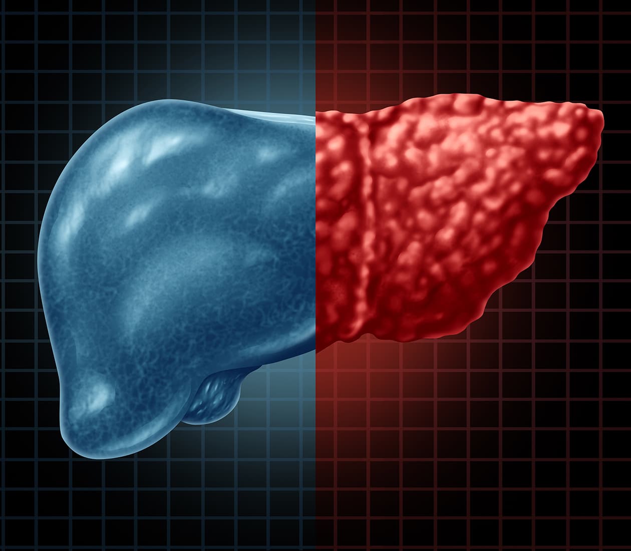 Liver Cancer Program