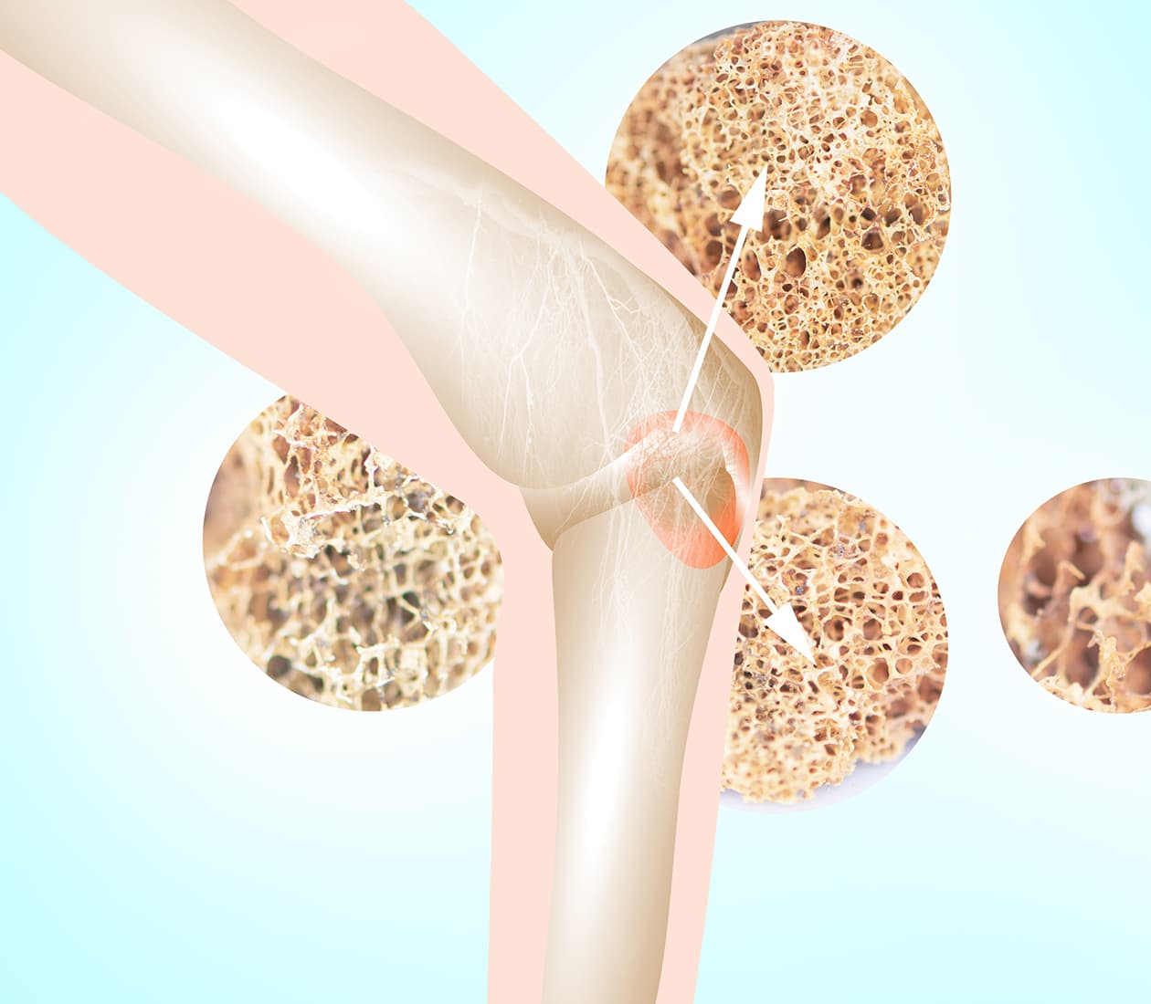 Colorectal Cancer Program