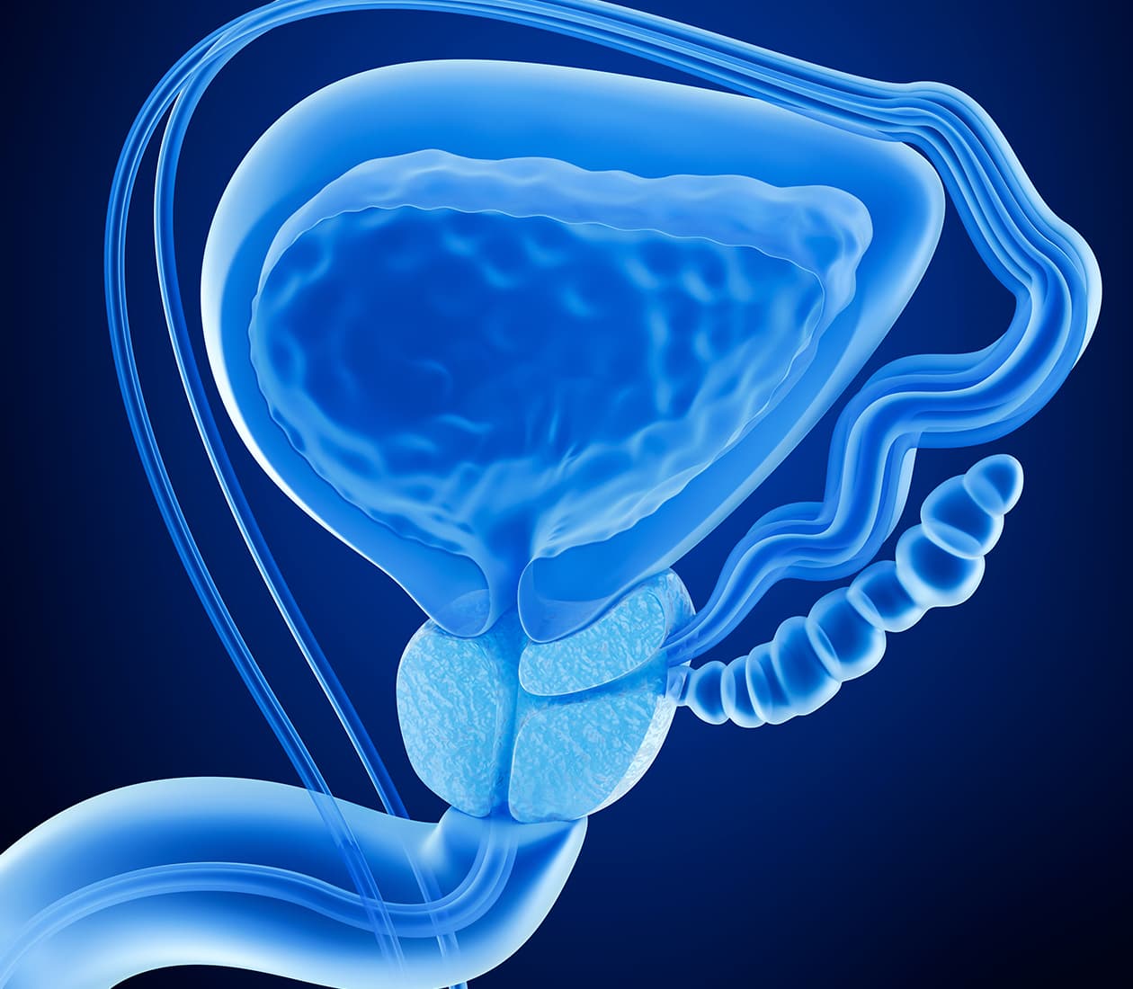 Prostate Cancer Program