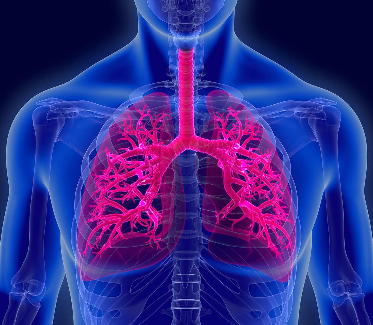 Tracheal Tumors