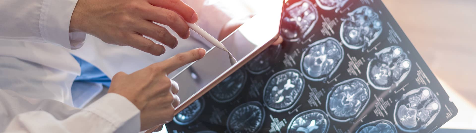 Brain and Spinal Cord Tumors Program