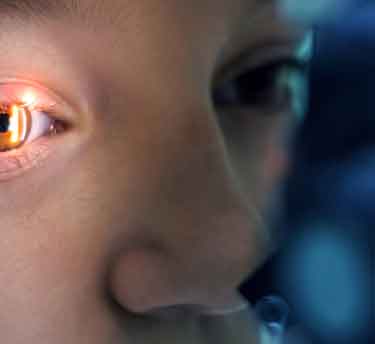Eye Cancer Treatment and Diagnosis in Abu Dhabi | Eye Tumor