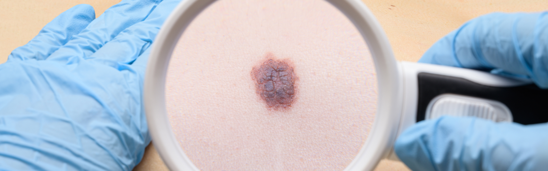 Soft Tissue Cancer Program