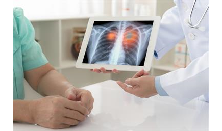 فحص الكشف عن سرطان الرئة