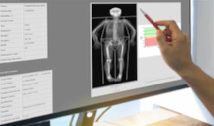 ابتعد عن مقاييس الميزان