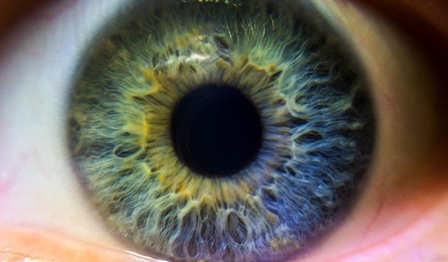 ما هو الاستجماتيزم؟